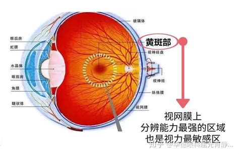 永城同辉眼科科普激光笔照射眼睛，可能会导致孩子眼底永久性损伤！ - 知乎