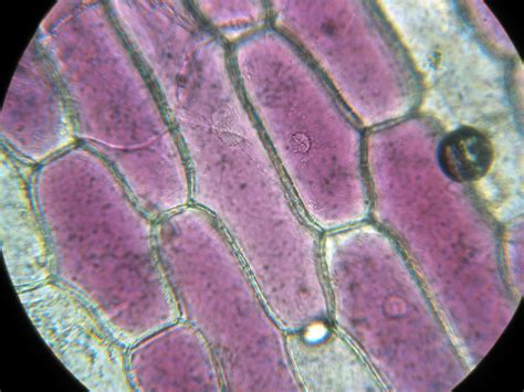 File:Red Onion Cells.JPG - Wikipedia