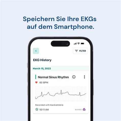 alivecor cardia mobile ecg 0.6 oz / 170 g black India | Ubuy