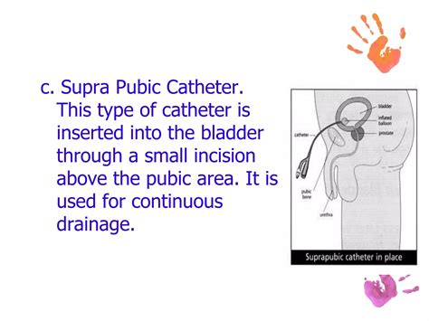 Urinary Catheterization | PPTX