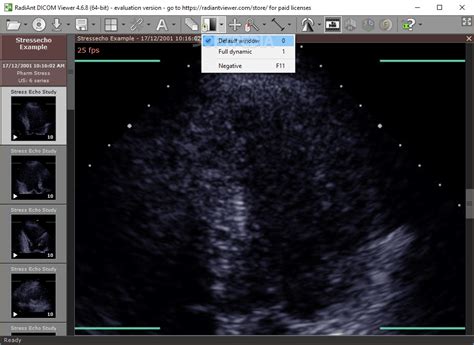 RadiAnt DICOM Viewer - Download - Softpedia