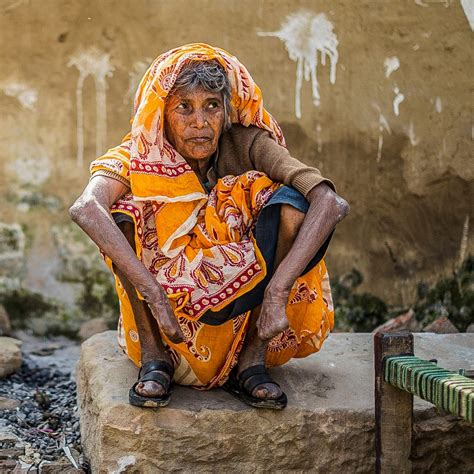 UNDERSTANDING LEPROSY - Rising Star Outreach