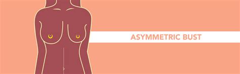 Breast Shapes & Recommended Bra Types | amanté