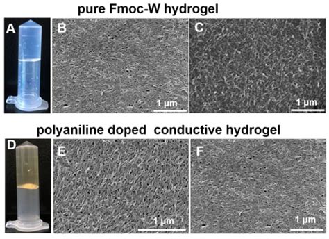 Gels | Special Issue : Advance in Supramolecular Gels