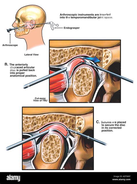 Temporomandibular joint hi-res stock photography and images - Alamy