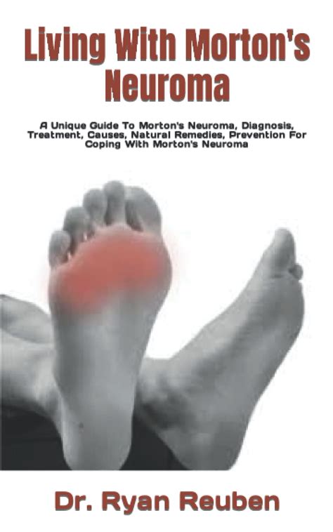 Buy Living With Morton's Neuroma: A Unique Guide To Morton's Neuroma ...