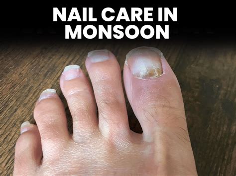 nails care tips in monsoon protect it from fungal infections and breakage