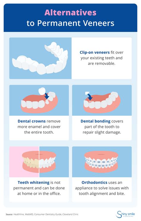 Alternatives To Veneers