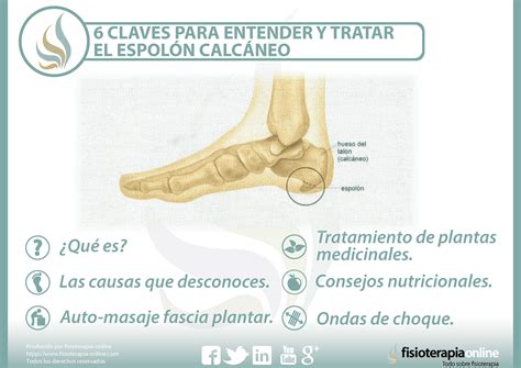 Descubre cómo tratar el espolón calcáneo: claves esenciales