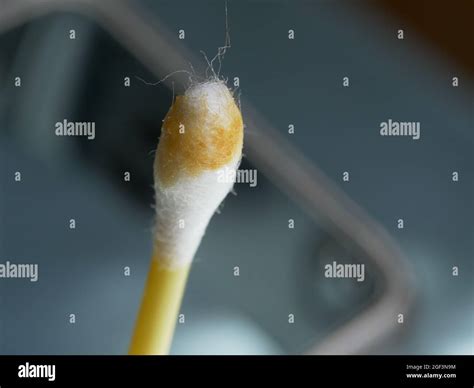 Earwax hi-res stock photography and images - Alamy