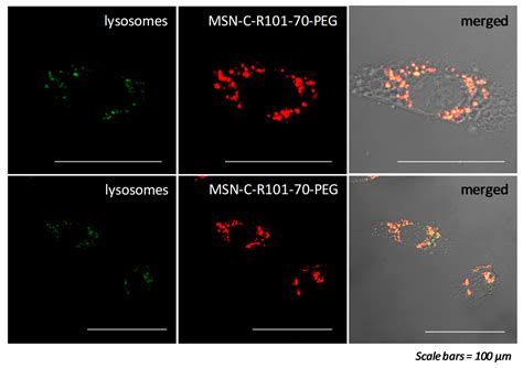 Functionalized Fluorescent Silica Nanoparticles for Bioimaging of ...