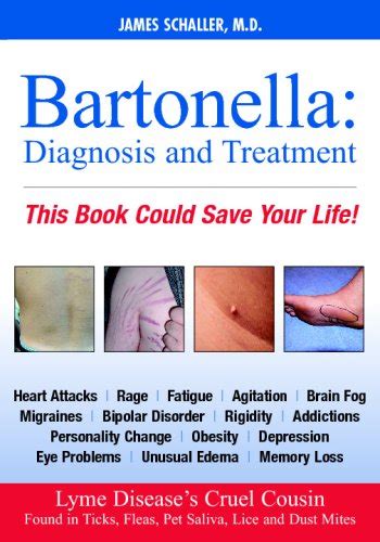 Buy Bartonella: Diagnosis and Treatment - A Major Cause of Lyme Disease ...