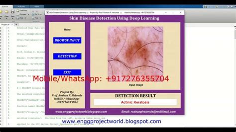 Image result for Skin Disease Detection Using MATLAB