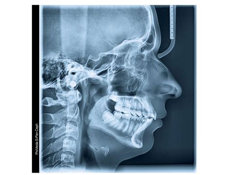 ProVecta S-Pan Cephalometric X-Ray - Air Techniques