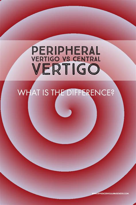 Peripheral vertigo - serrefake
