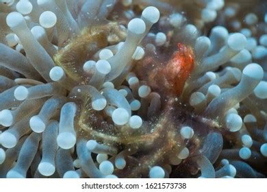 Acetobacter Isolation Process Image 的图像结果