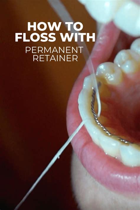 Image result for Floss Threader Fixed Retainer