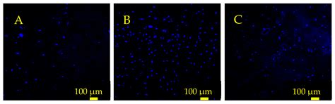 Magnetoelastic Monitoring System for Tracking Growth of Human ...