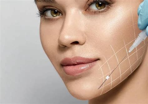 The Complete Guide to Thread Lifts: Everything You Need to Know