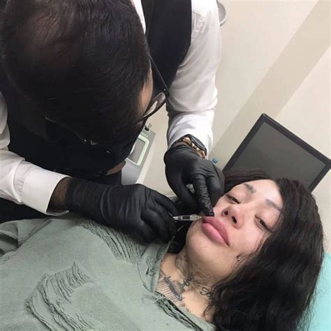 Shruti Haasan’s Rhinoplasty: A Journey To Self-Transformation | Bizrahmed