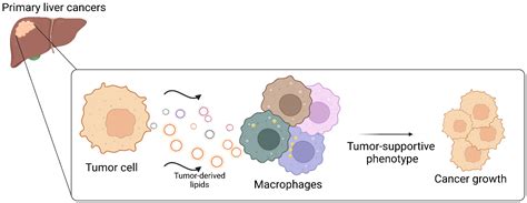 Lipid Metabolism Reprogramming in Tumor-Associated Macrophages ...