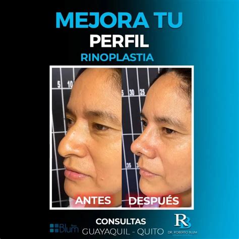 Dr. Roberto Blum Andrade: Avances pioneros en la investigación con ...