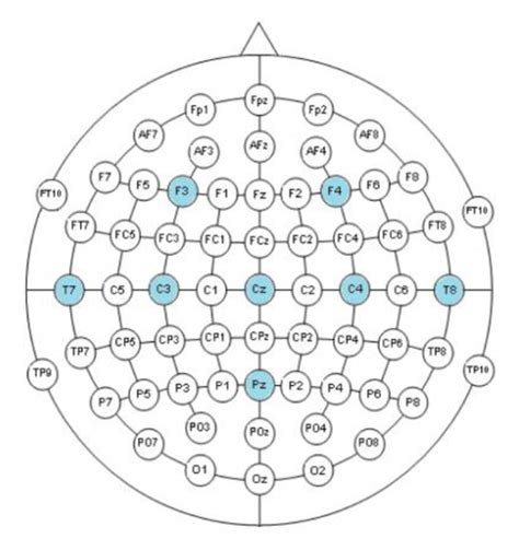 Low-Cost Robotic Guide Based on a Motor Imagery Brain–Computer ...