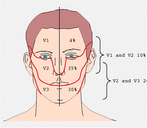 Trigeminal neuralgia and its management | The BMJ