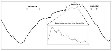 A Spectral-Based Approach for BCG Signal Content Classification
