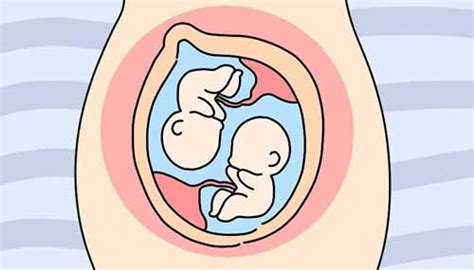 试管婴儿胎停的几率大吗，试管胎停后自然怀孕的多吗