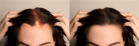 12 Proven Natural Hair Growth Tips for Indian Hair – Soulflower.in