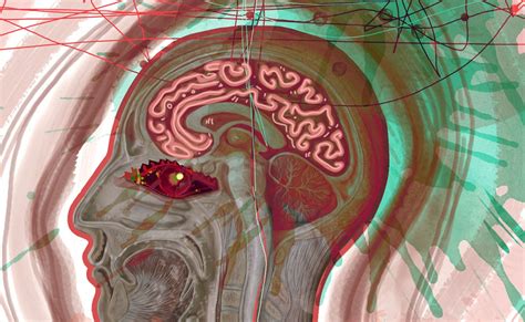 Brain stroke : जानिए क्यों होता है ब्रेन स्ट्रोक और क्या होते हैं इसके ...