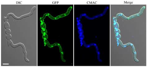 Stage-Specific Genetic Interaction between FgYCK1 and FgBNI4 during ...