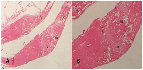 The Effect of Local Melatonin Application on Bone Fracture Healing in ...