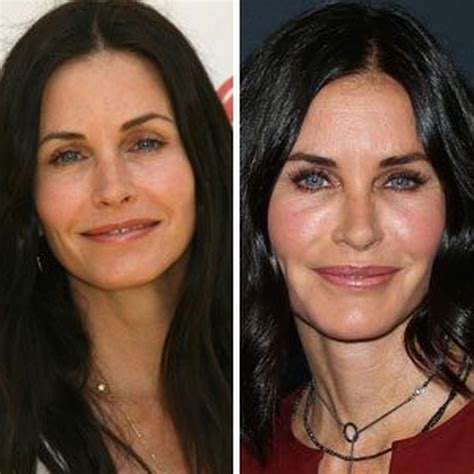 Courteney Cox After Plastic Surgery Courteney Cox Has Had Her Fillers