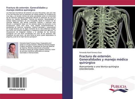 Sternum fracture. Surgical Medical Generals & | Ubuy India