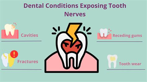 What Is An Exposed Nerve In A Tooth at Kevin Carnahan blog