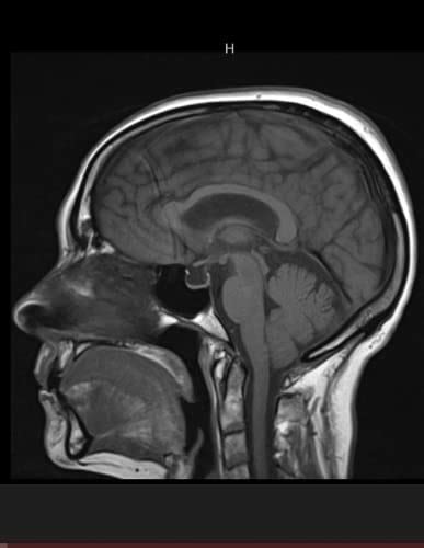 Buy Was Brain History: Interesting Accidents, Experiments and ...