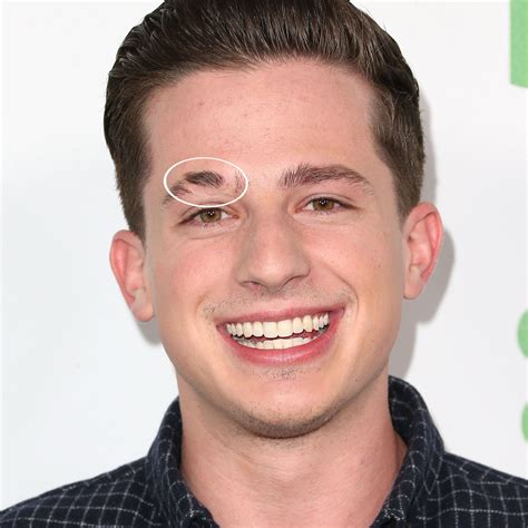 Miles Teller Scars