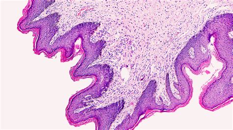 How to Increase Gut Motility | Thorne