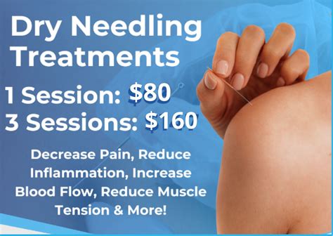 A Complete Guide to the Cost of Dry Needling