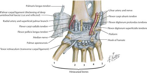 Acute Carpal Tunnel Syndrome - Orthopedic Clinics