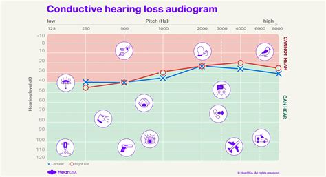 Conductive Hearing Loss - The Complete Guide [2024]