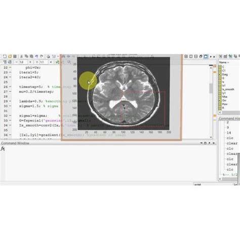 Image result for Medical Image Segmentation MATLAB
