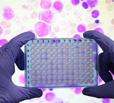 Molecular Genetics Lab 的图像结果