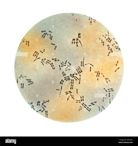 This illustration depicts a photomicrographic view of Corynebacterium ...