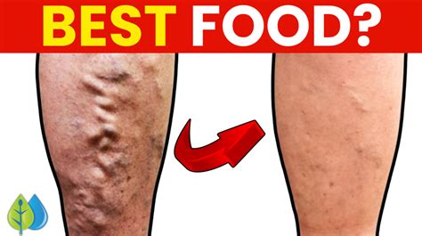 Image result for Leg Circulation Problems Symptoms