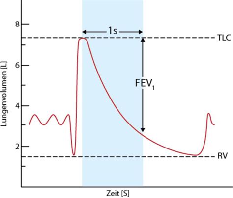Cuadro De Rango Normal De Fev1 Asma: Concepto, Fisiopatología,