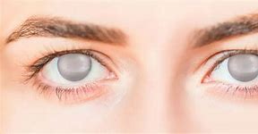 Image result for blindness