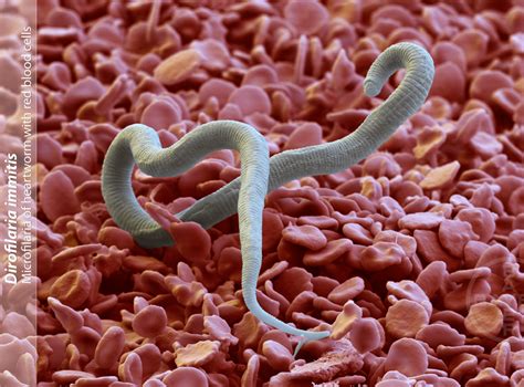 Common Symptoms of Parasites – Real Food Rebel